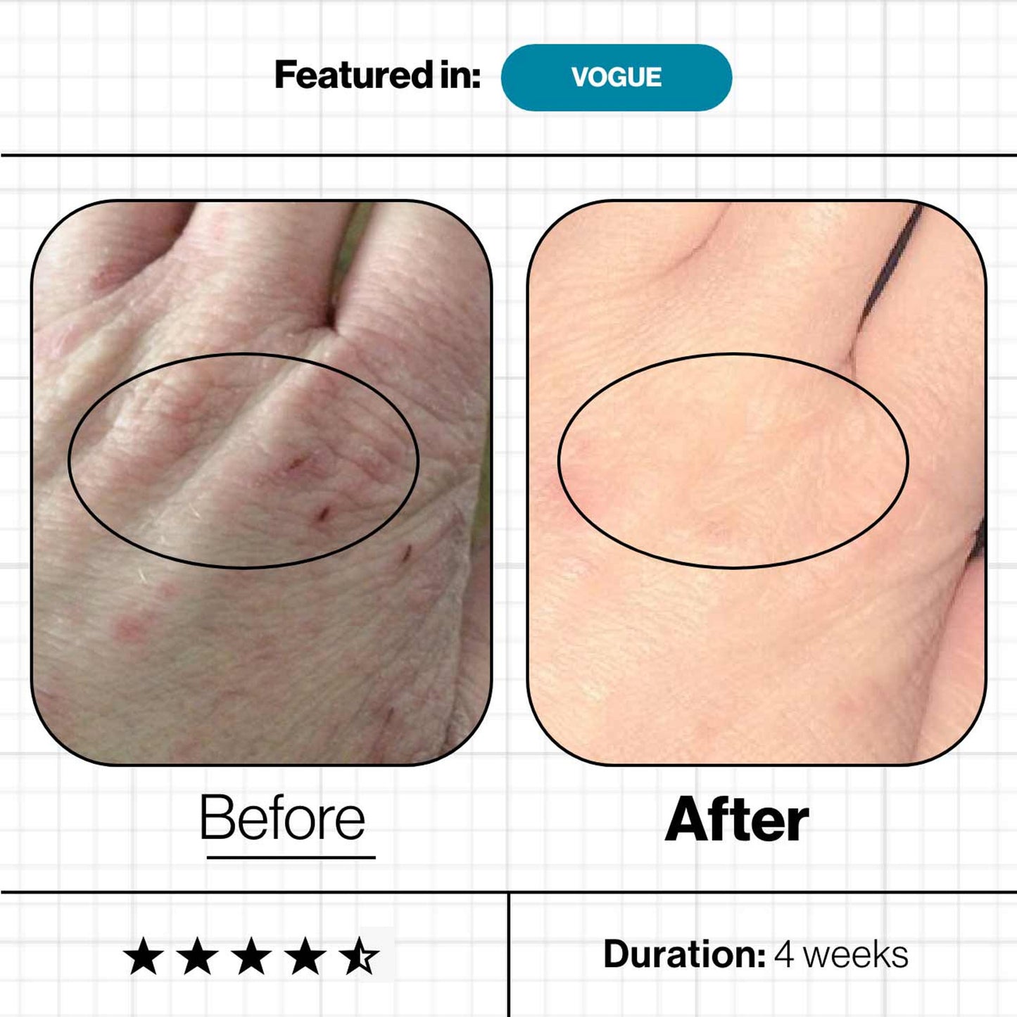 Skin Omegas
