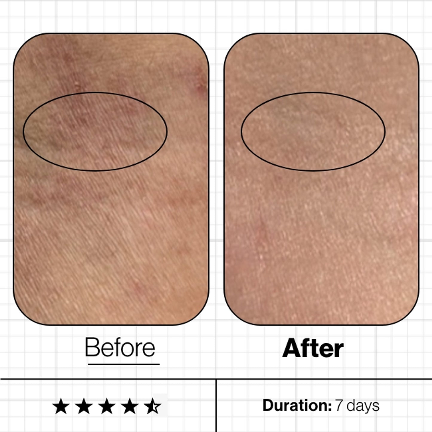 Skin Moisture Lock™